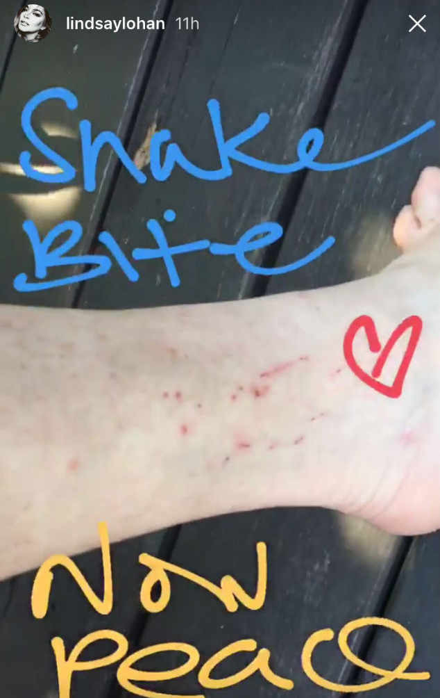 Lindsay Lohan mordida por uma cobra.jpg