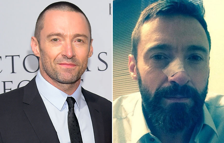 Hugh Jackman.jpg