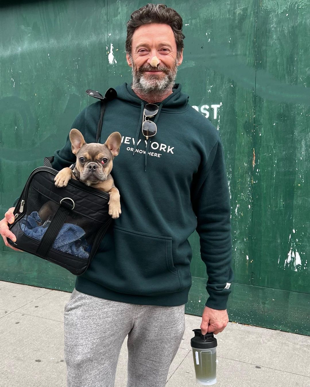 Hugh Jackman revela que pode estar de novo doente