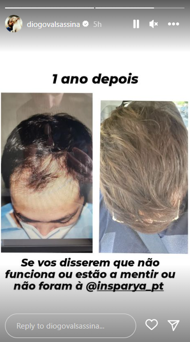 A transformação