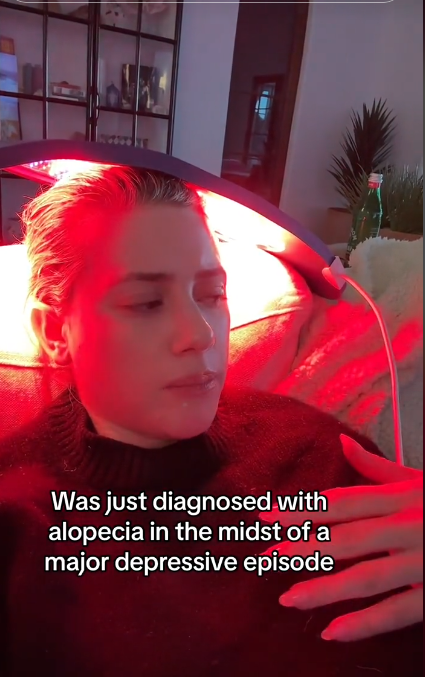 Lili Reinhart recebe tratamento para a alopecia
