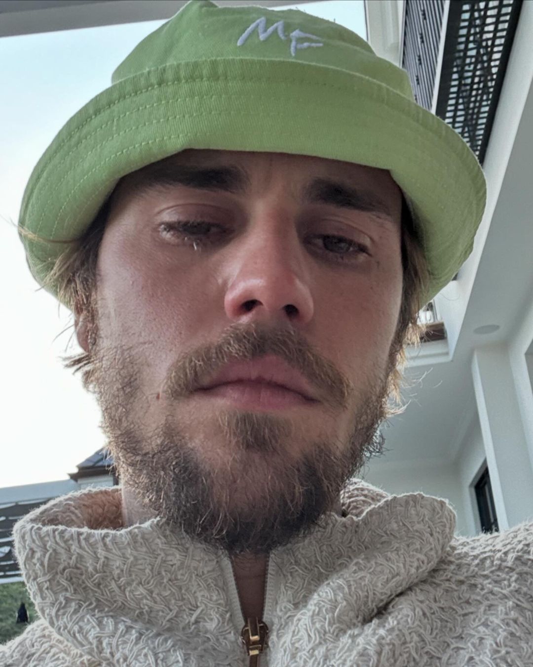 A publica&ccedil;&atilde;o de Justin Bieber que est&aacute; a preocupar os f&atilde;s